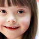Illustration for article titled Scientists May Have Found a Genomic Off Switch for Down Syndrome